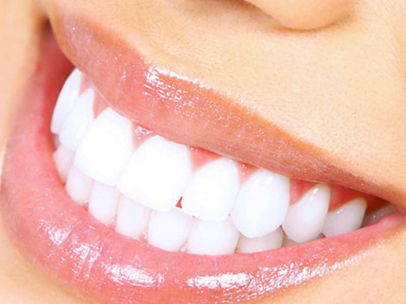 Denti nuovi in 24 ore Denti nuovi in 24 ore