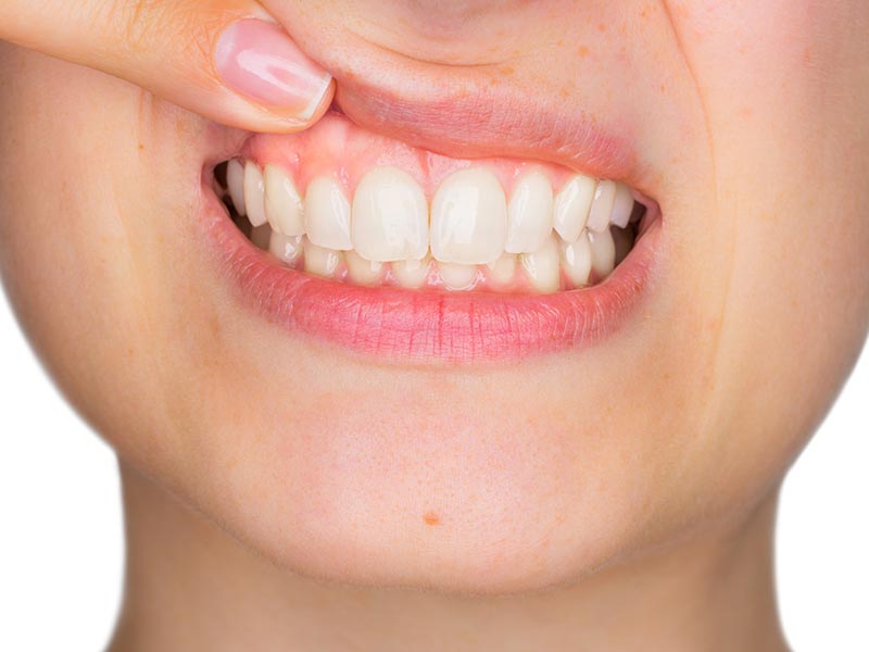 Una bocca a prova di sorriso Una bocca a prova di sorriso