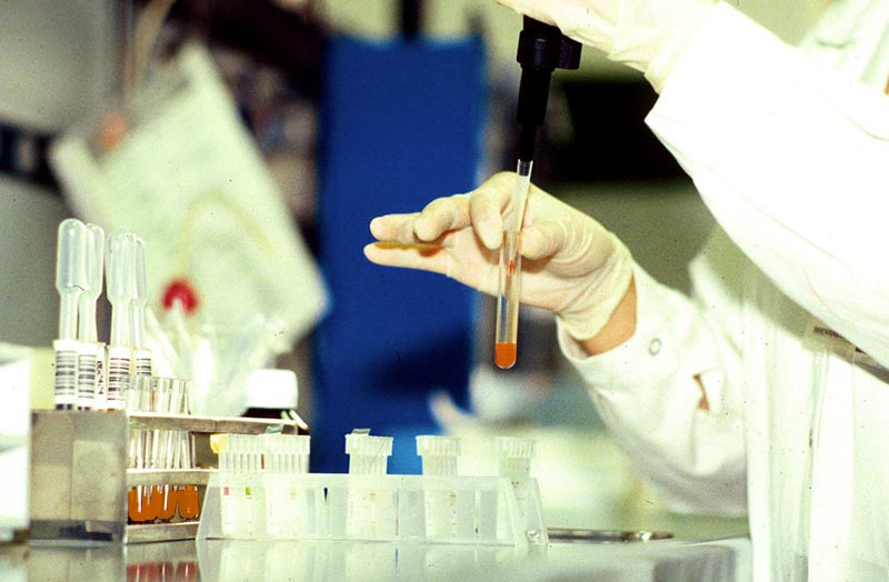 Epatite da curcuma, un caso anche nel casertano Epatite da curcuma, un caso anche nel casertano